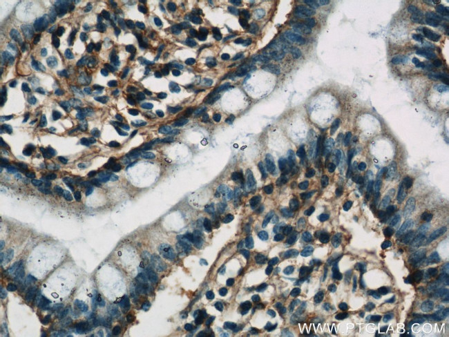 HLA-A Antibody in Immunohistochemistry (Paraffin) (IHC (P))