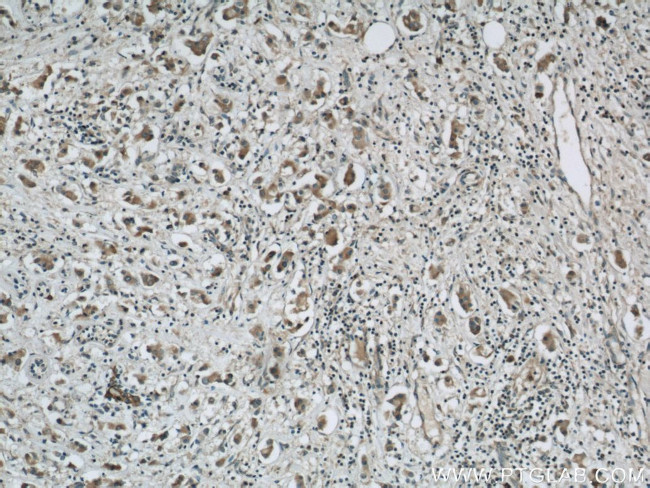 PGAP1 Antibody in Immunohistochemistry (Paraffin) (IHC (P))