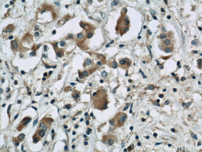 PGAP1 Antibody in Immunohistochemistry (Paraffin) (IHC (P))