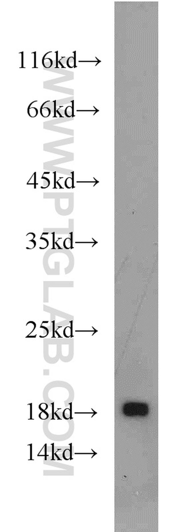 DR3 Antibody in Western Blot (WB)