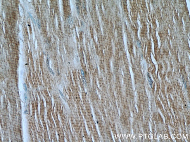 FAM13A Antibody in Immunohistochemistry (Paraffin) (IHC (P))