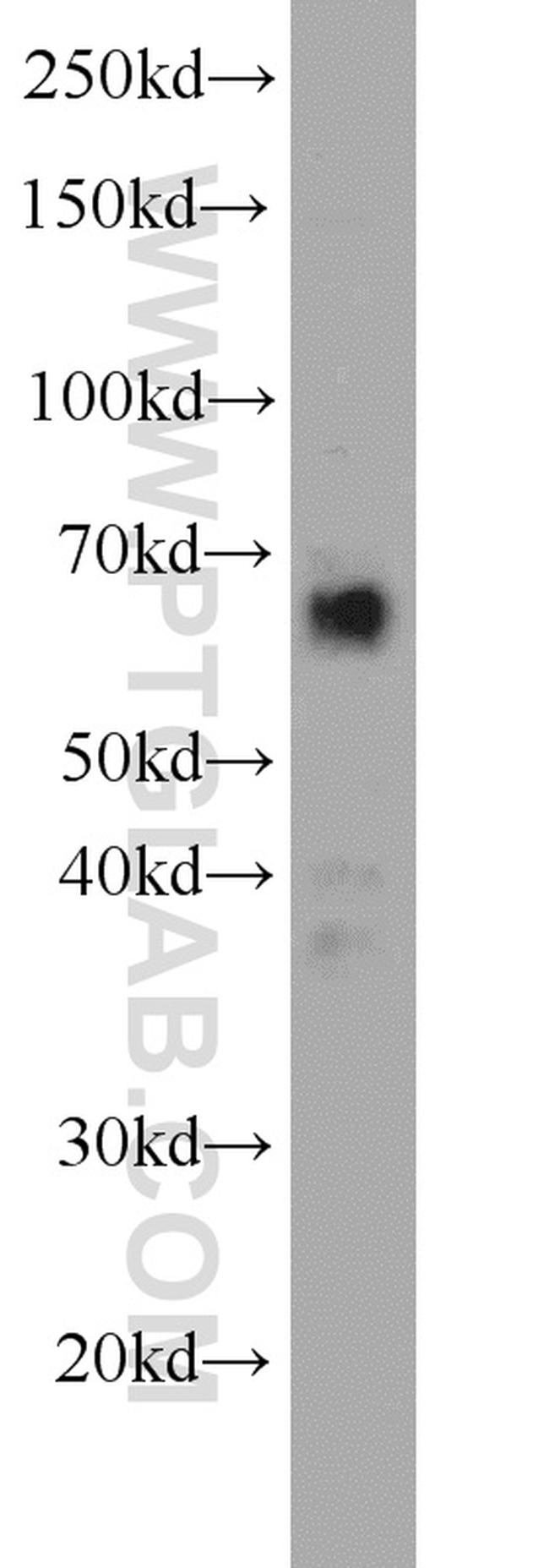 FAM13A Antibody in Western Blot (WB)