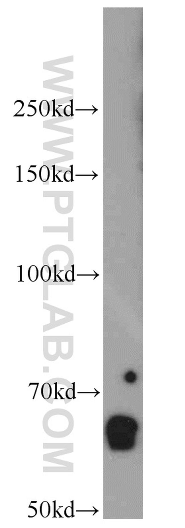 FAM13A Antibody in Western Blot (WB)