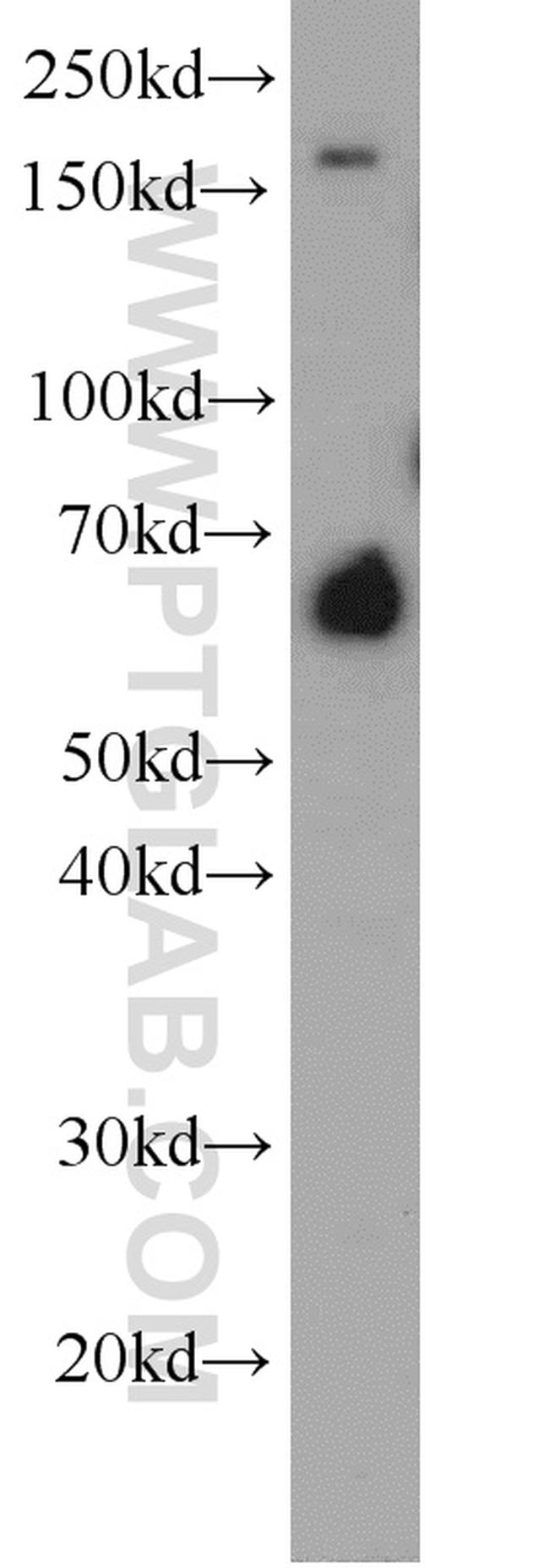 FAM13A Antibody in Western Blot (WB)