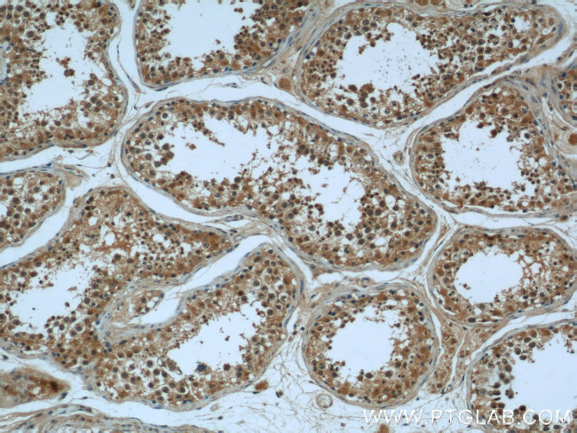 KIF15 Antibody in Immunohistochemistry (Paraffin) (IHC (P))