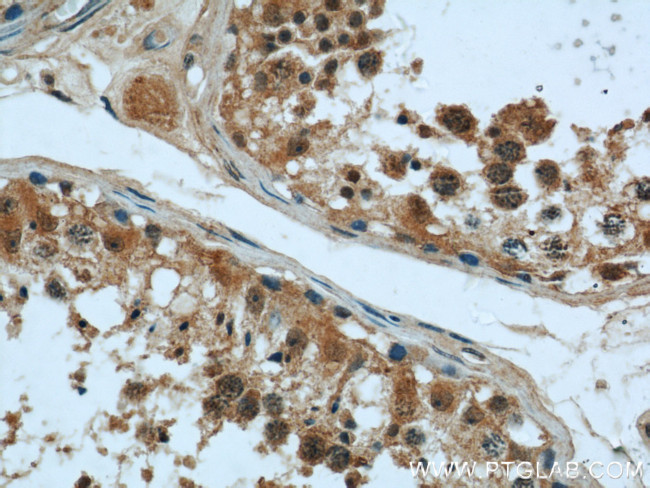 KIF15 Antibody in Immunohistochemistry (Paraffin) (IHC (P))