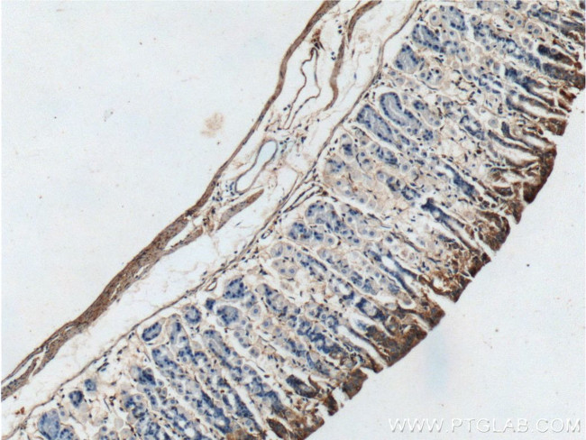 TMEM181 Antibody in Immunohistochemistry (Paraffin) (IHC (P))