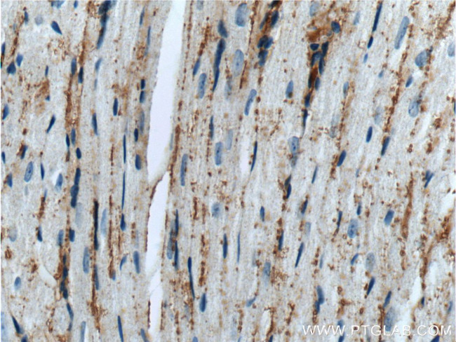 TMEM181 Antibody in Immunohistochemistry (Paraffin) (IHC (P))