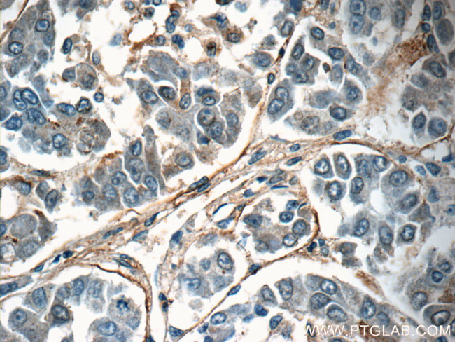 TMEM181 Antibody in Immunohistochemistry (Paraffin) (IHC (P))