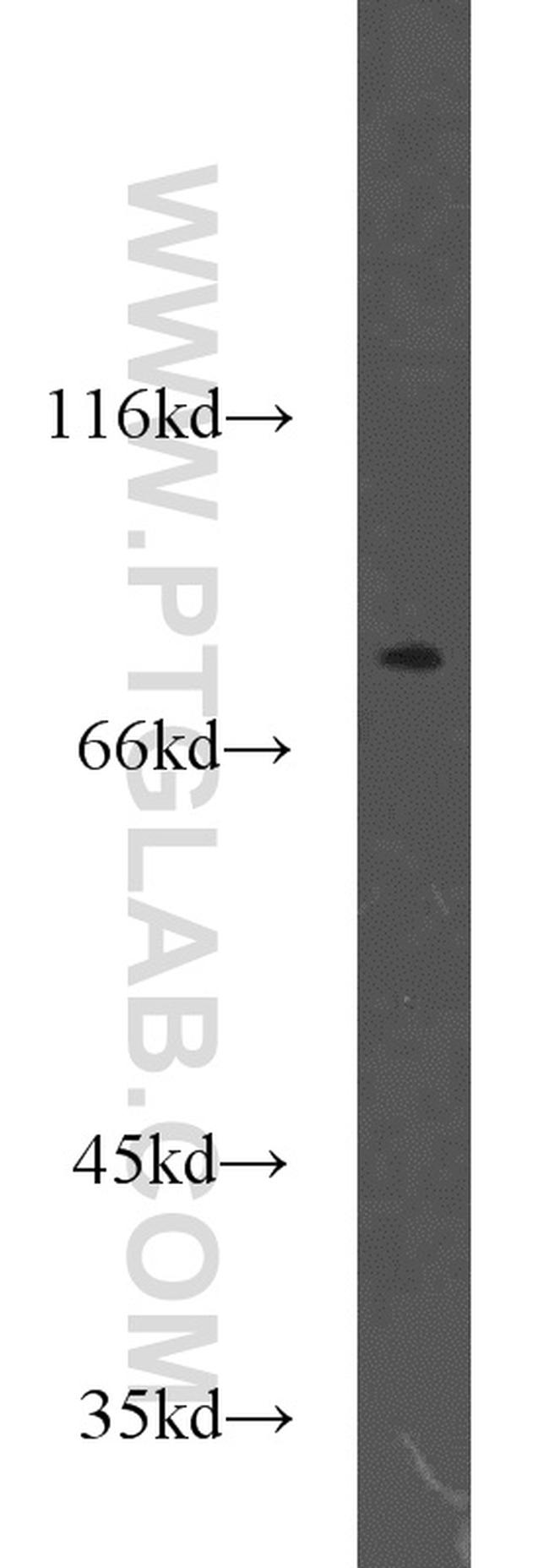 TMEM181 Antibody in Western Blot (WB)