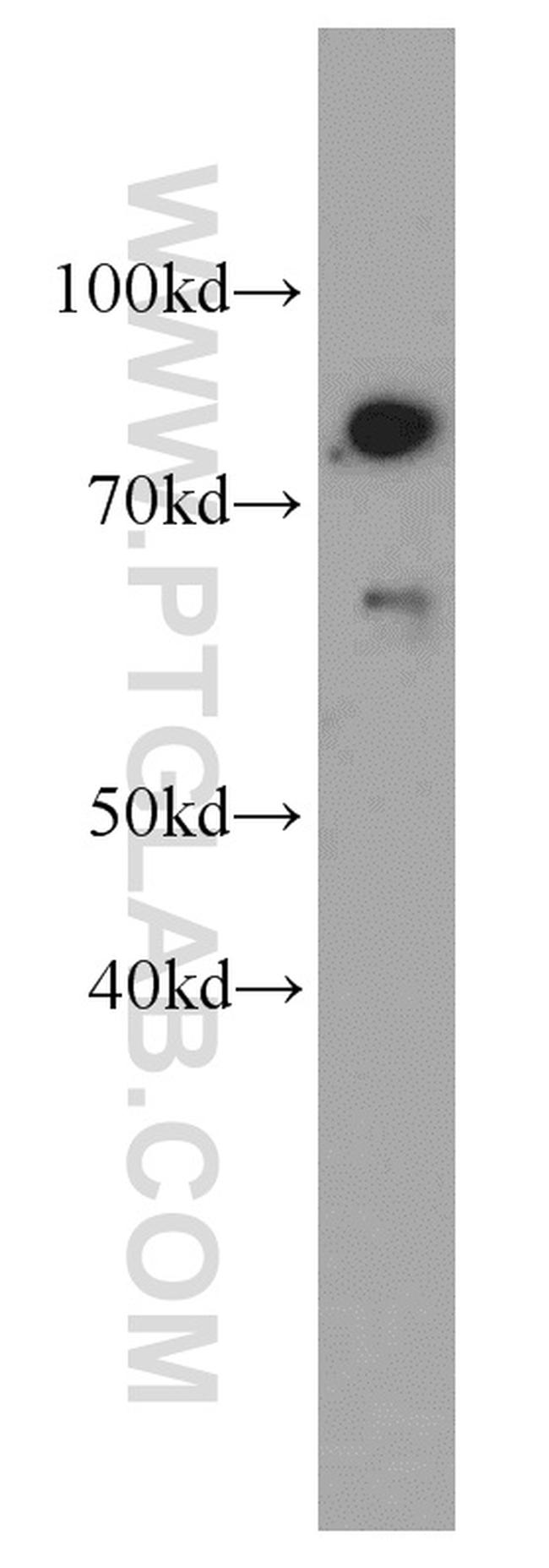 TMEM181 Antibody in Western Blot (WB)