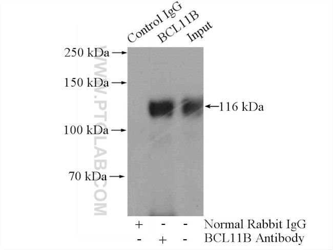 BCL11B Antibody in Immunoprecipitation (IP)