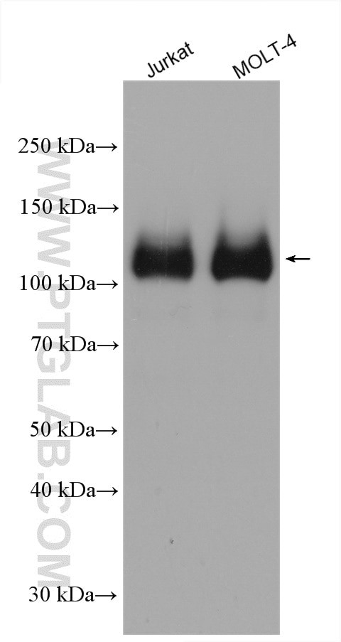 BCL11B Antibody in Western Blot (WB)