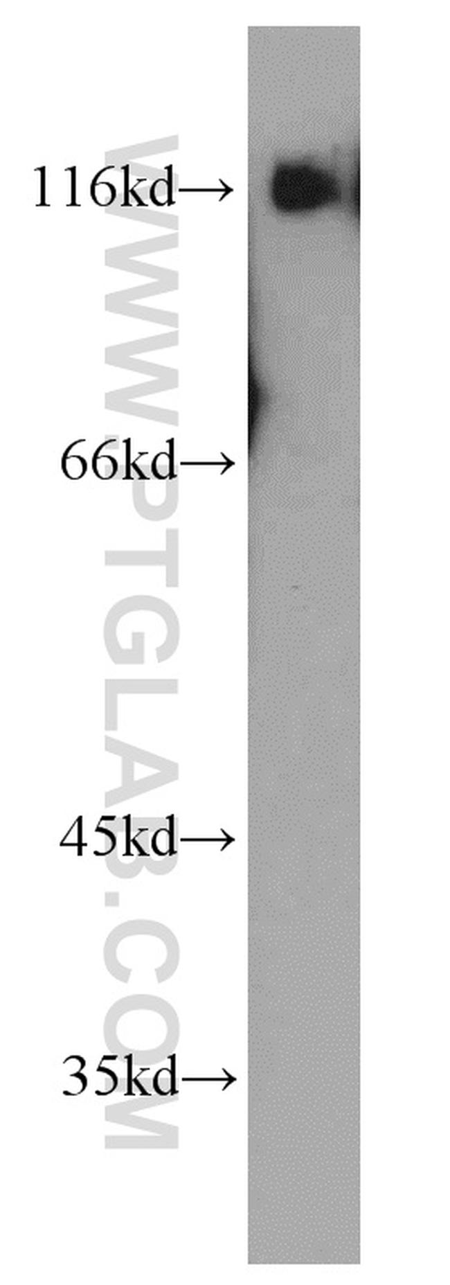 BCL11B Antibody in Western Blot (WB)