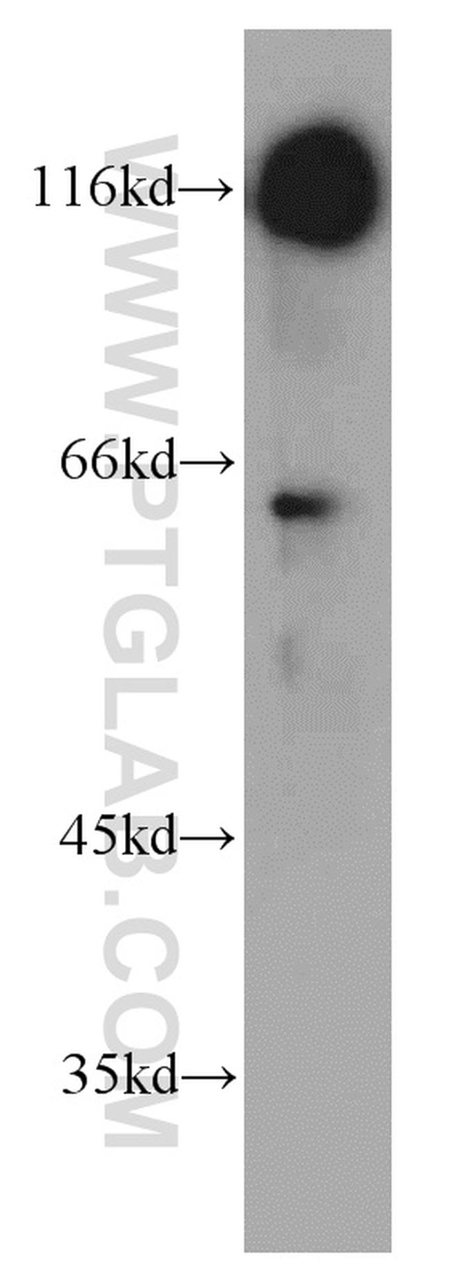 BCL11B Antibody in Western Blot (WB)