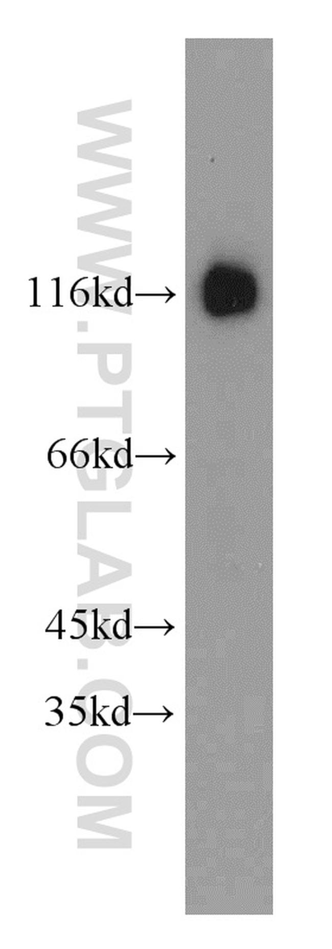 BCL11B Antibody in Western Blot (WB)