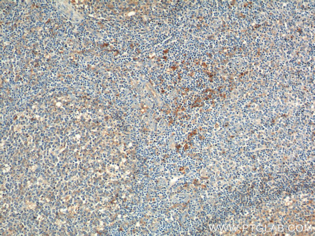 CD169 Antibody in Immunohistochemistry (Paraffin) (IHC (P))