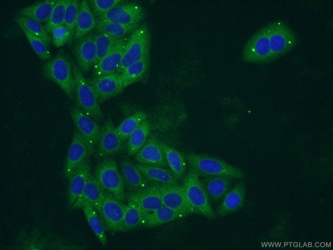 PYGL Antibody in Immunocytochemistry (ICC/IF)