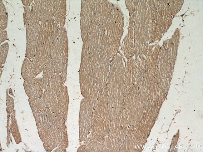 PYGL Antibody in Immunohistochemistry (Paraffin) (IHC (P))