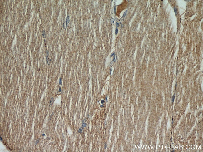 PYGL Antibody in Immunohistochemistry (Paraffin) (IHC (P))