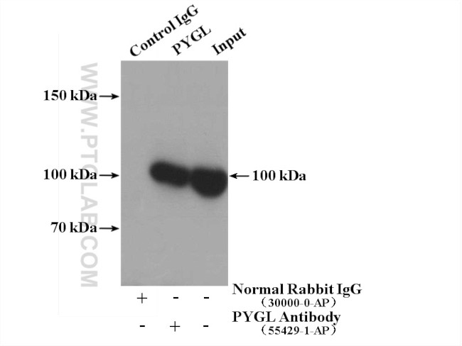 PYGL Antibody in Immunoprecipitation (IP)