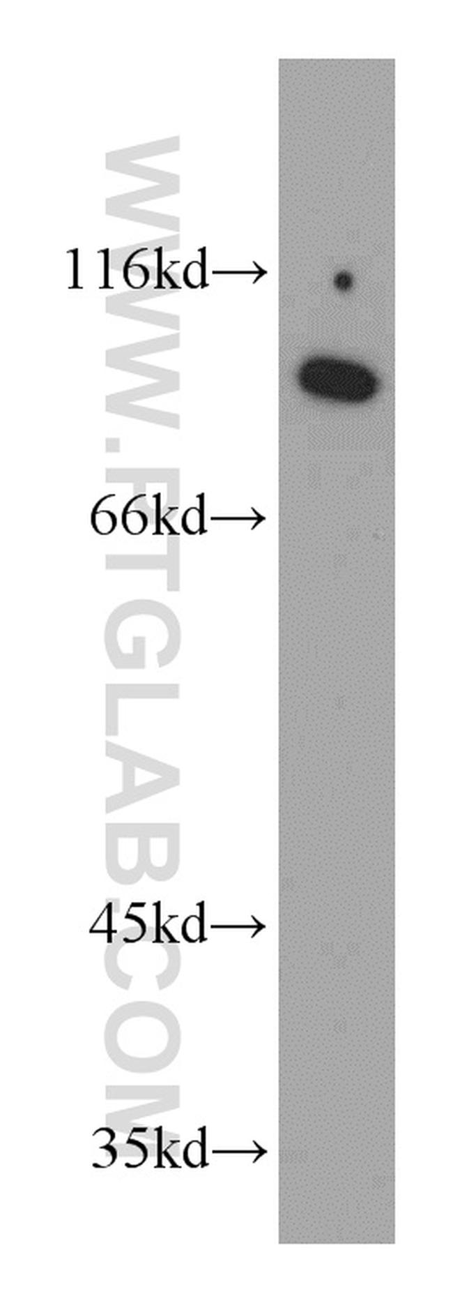 PYGL Antibody in Western Blot (WB)