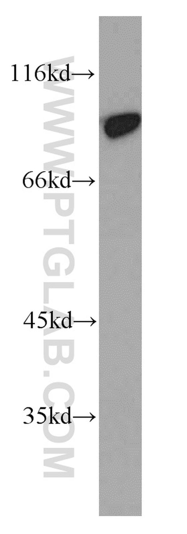 PYGL Antibody in Western Blot (WB)