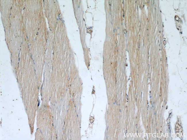 STUB1 Antibody in Immunohistochemistry (Paraffin) (IHC (P))