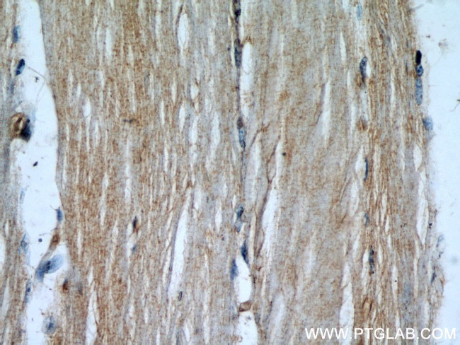 STUB1 Antibody in Immunohistochemistry (Paraffin) (IHC (P))