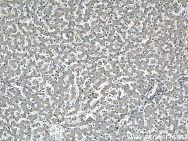 STUB1 Antibody in Immunohistochemistry (Paraffin) (IHC (P))