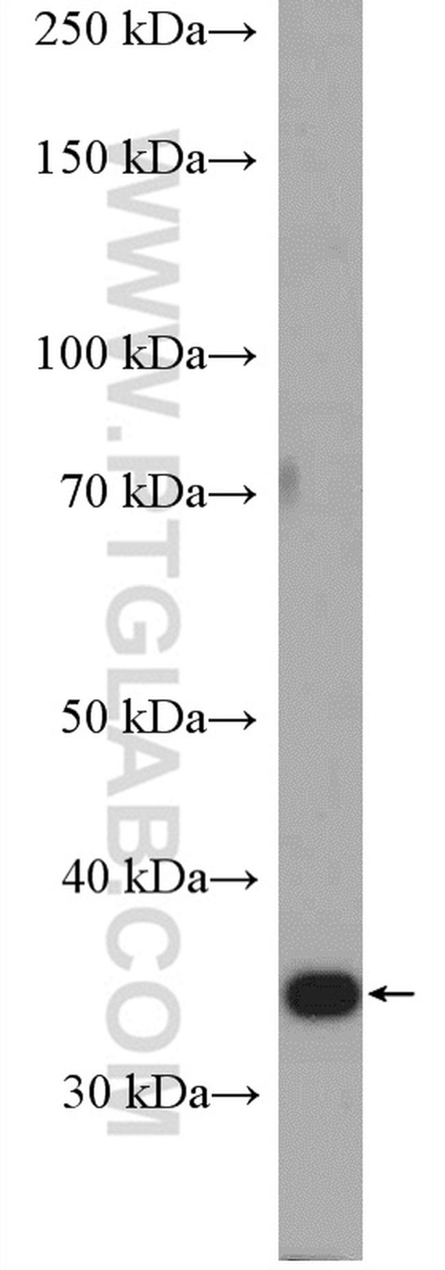 STUB1 Antibody in Western Blot (WB)