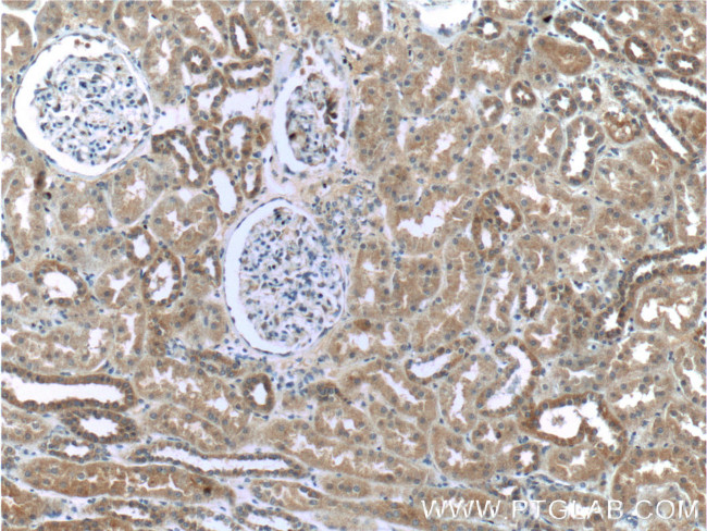 WTX Antibody in Immunohistochemistry (Paraffin) (IHC (P))