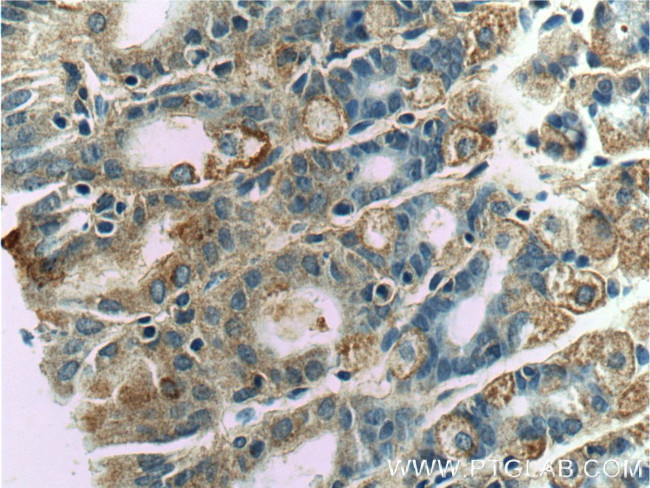 WTX Antibody in Immunohistochemistry (Paraffin) (IHC (P))