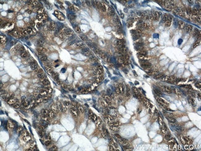 GATA5 Antibody in Immunohistochemistry (Paraffin) (IHC (P))