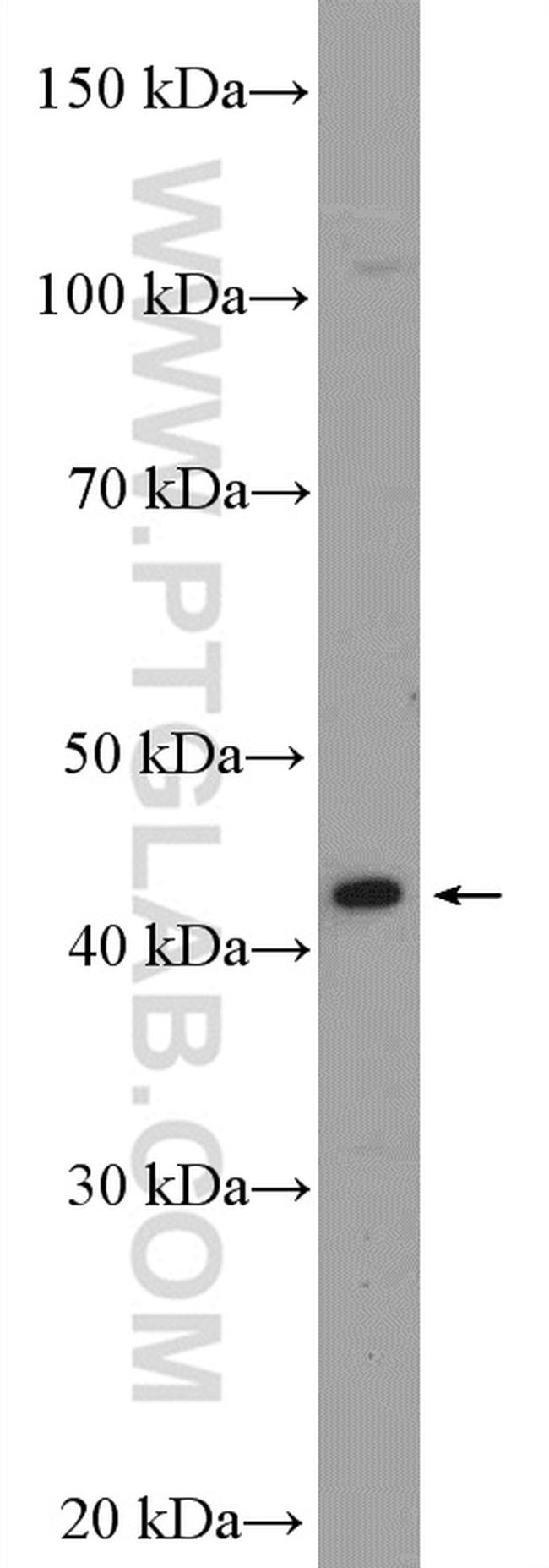 GATA5 Antibody in Western Blot (WB)