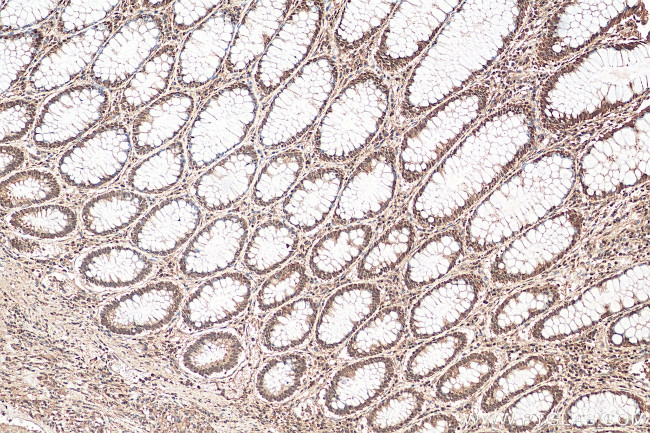 GATA6 Antibody in Immunohistochemistry (Paraffin) (IHC (P))