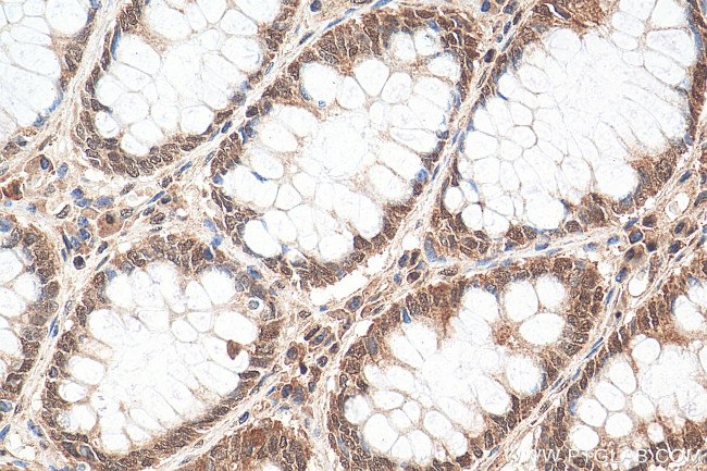 GATA6 Antibody in Immunohistochemistry (Paraffin) (IHC (P))