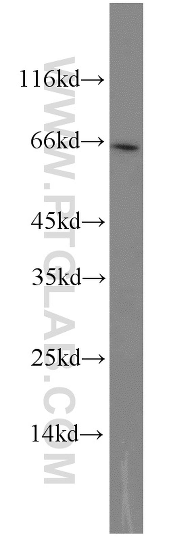 GATA6 Antibody in Western Blot (WB)