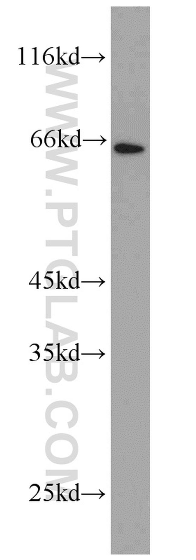 GATA6 Antibody in Western Blot (WB)