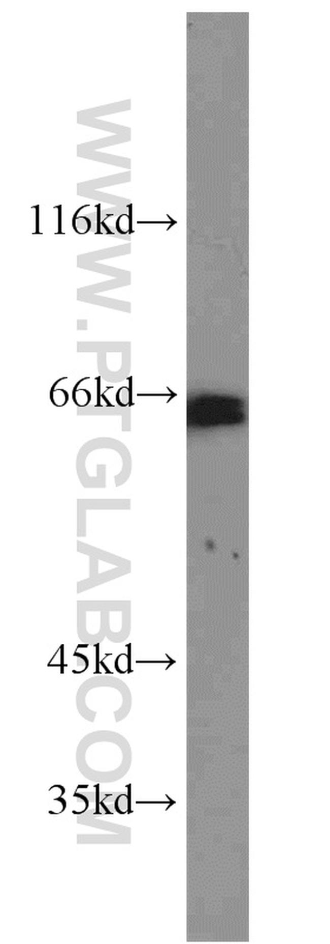 GATA6 Antibody in Western Blot (WB)