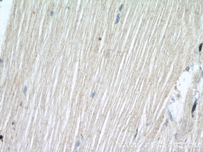 SCN4B Antibody in Immunohistochemistry (Paraffin) (IHC (P))