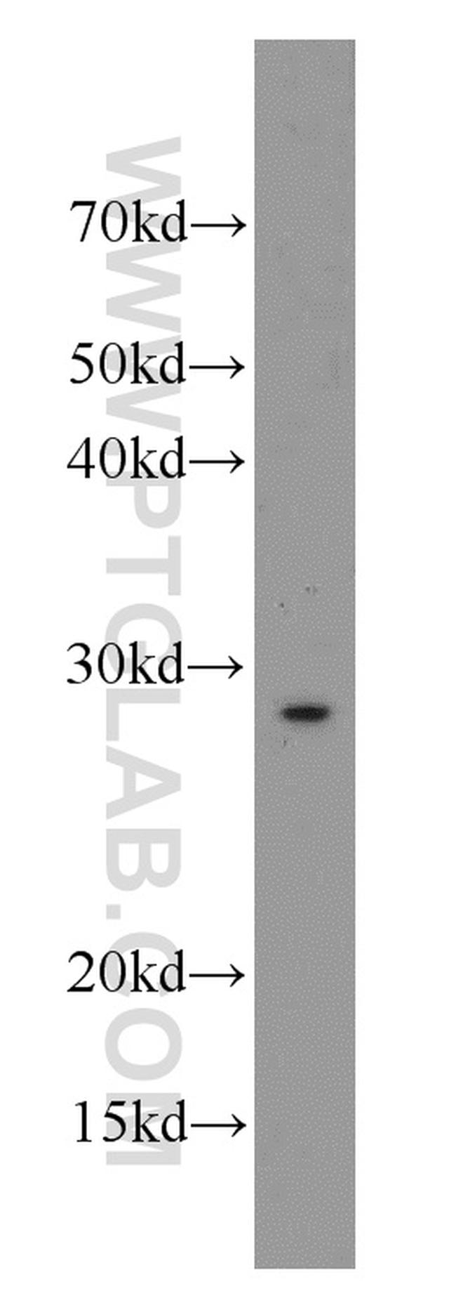 SCN4B Antibody in Western Blot (WB)