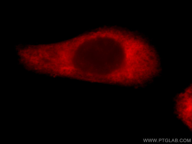 Loricrin Antibody in Immunocytochemistry (ICC/IF)