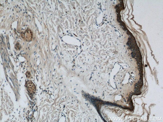 Loricrin Antibody in Immunohistochemistry (Paraffin) (IHC (P))