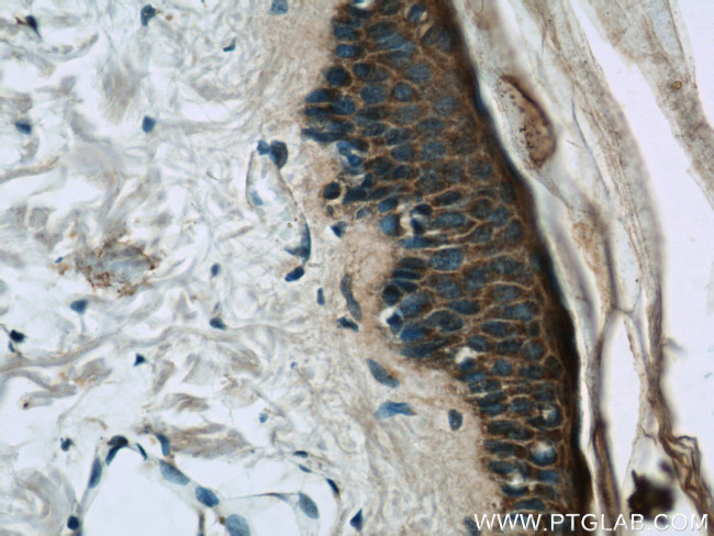 Loricrin Antibody in Immunohistochemistry (Paraffin) (IHC (P))