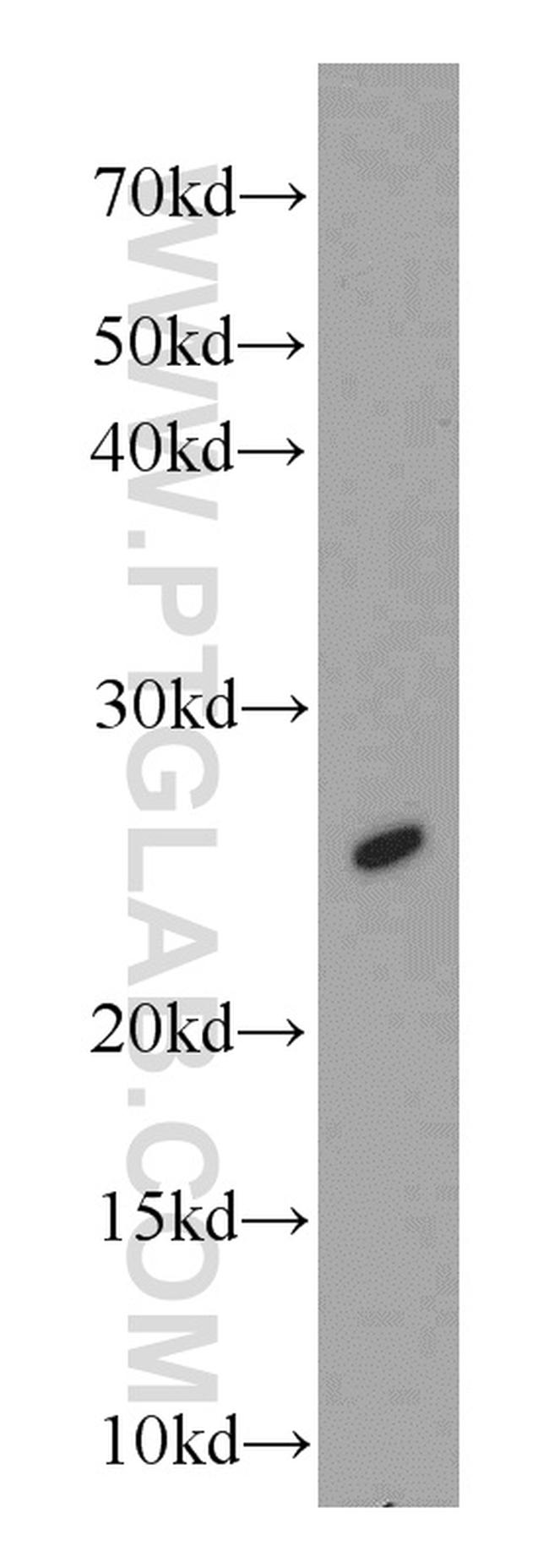 Loricrin Antibody in Western Blot (WB)