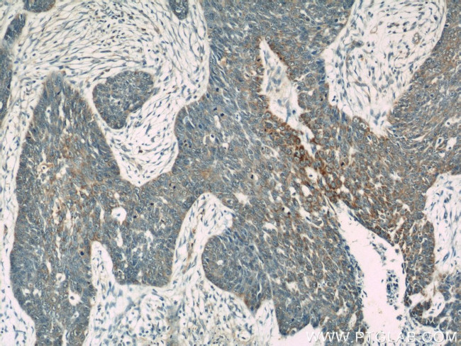 Loricrin Antibody in Immunohistochemistry (Paraffin) (IHC (P))