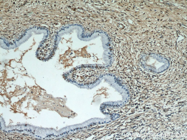 ESR2 Beta-3 Antibody in Immunohistochemistry (Paraffin) (IHC (P))