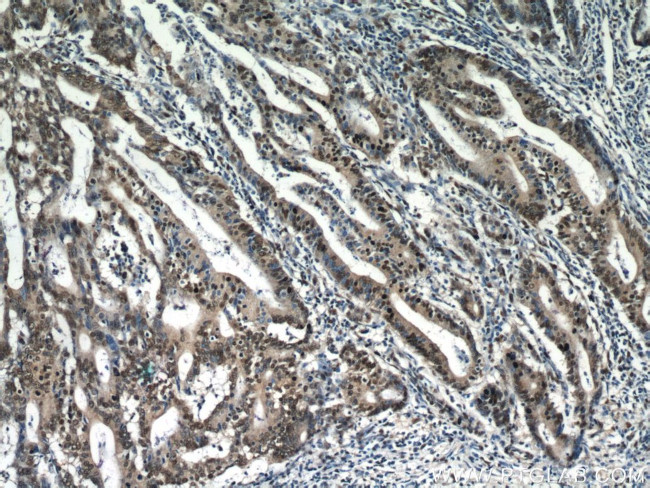 ESR2 Beta-3 Antibody in Immunohistochemistry (Paraffin) (IHC (P))