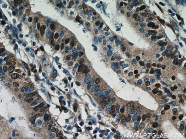 ESR2 Beta-3 Antibody in Immunohistochemistry (Paraffin) (IHC (P))